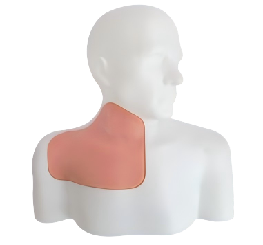 Ultrasound-Guided Central Venous Access Model