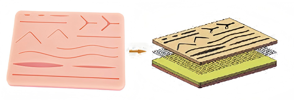 Suture Module