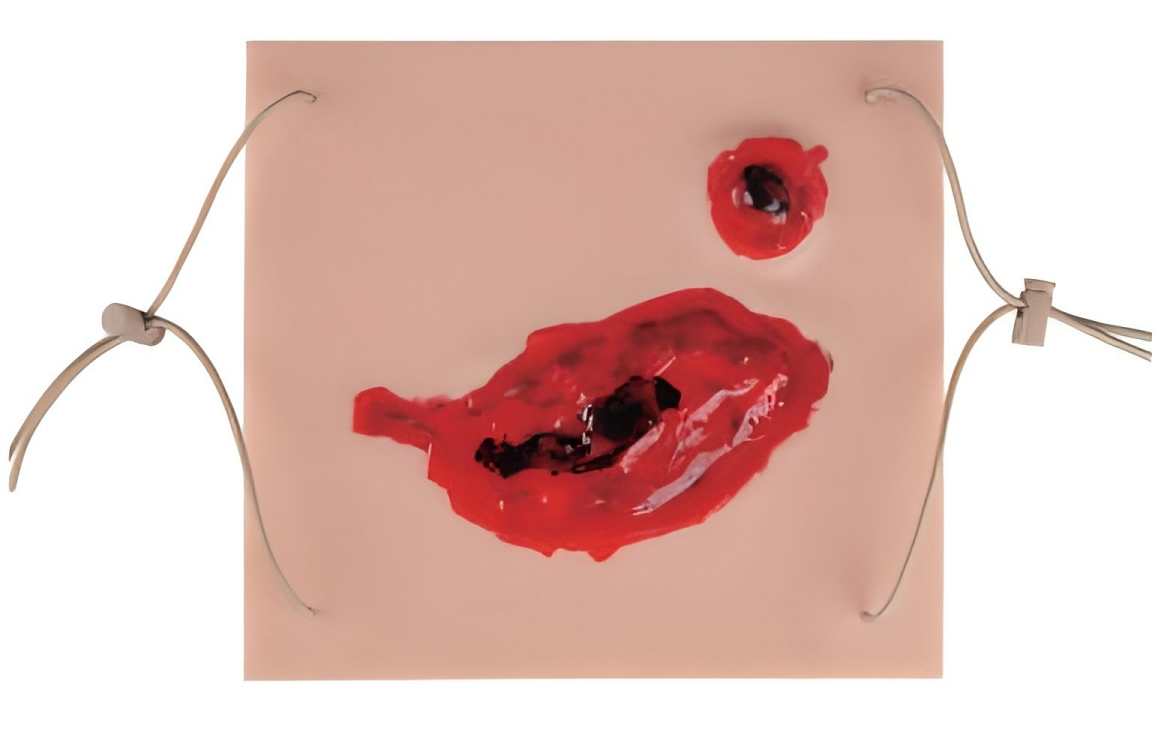 Wound pad I