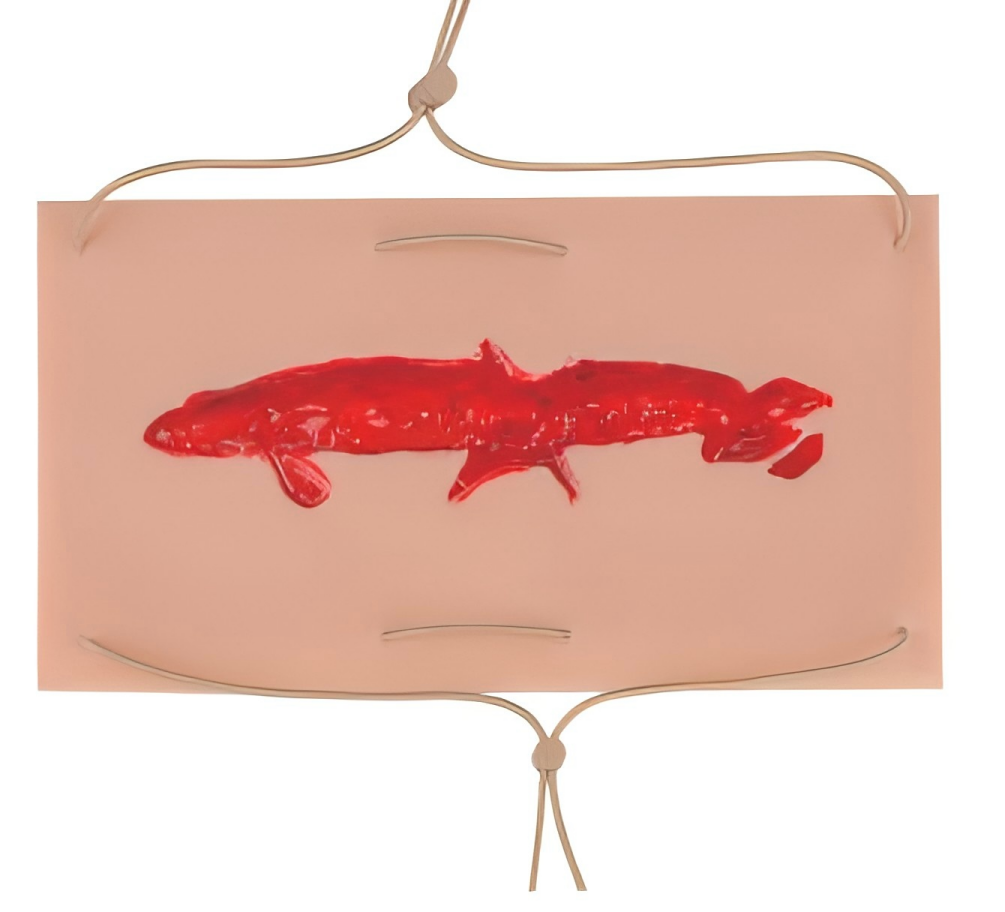 Wound pad II