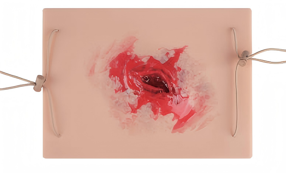 Wound skin pad