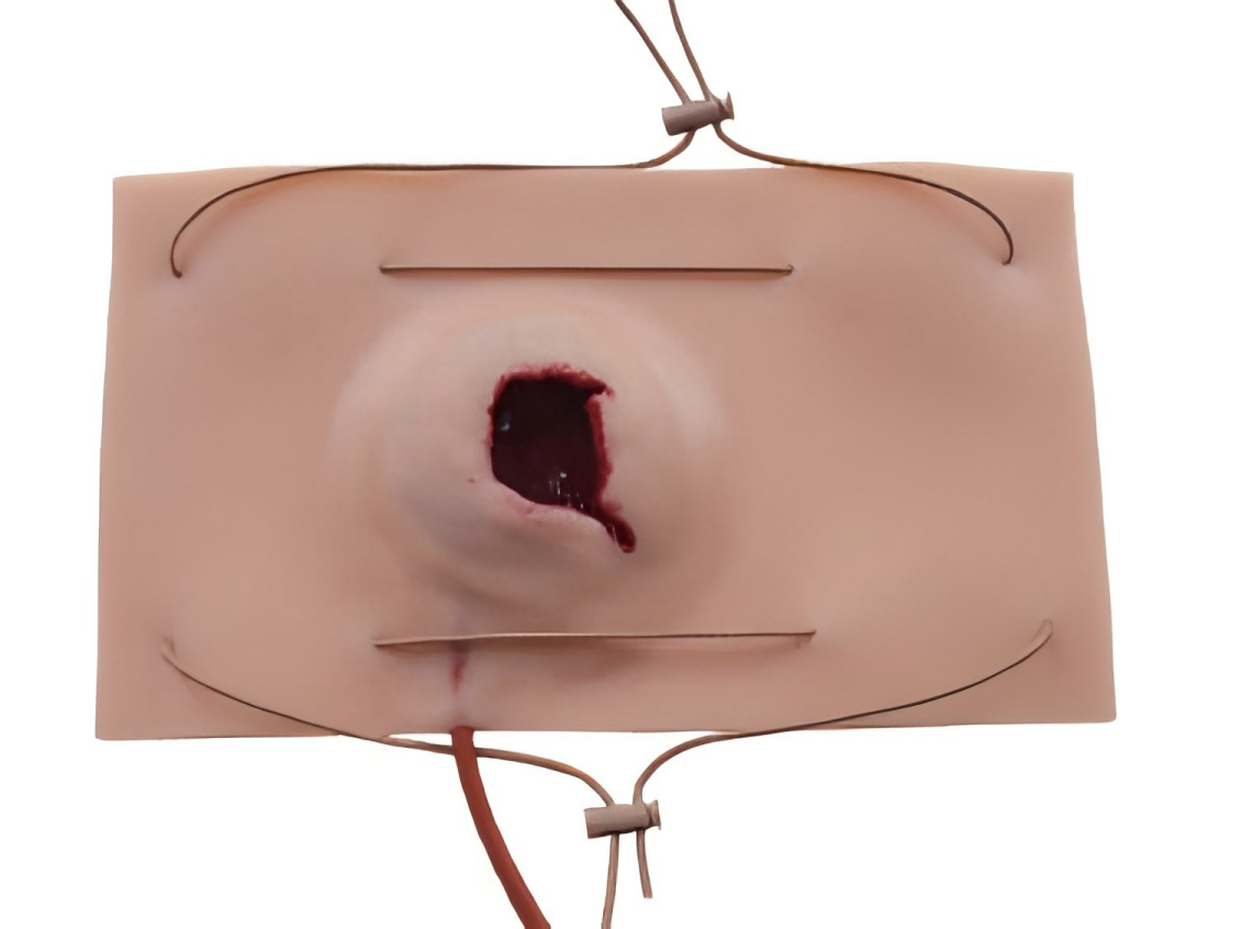 Gunshot Wound module