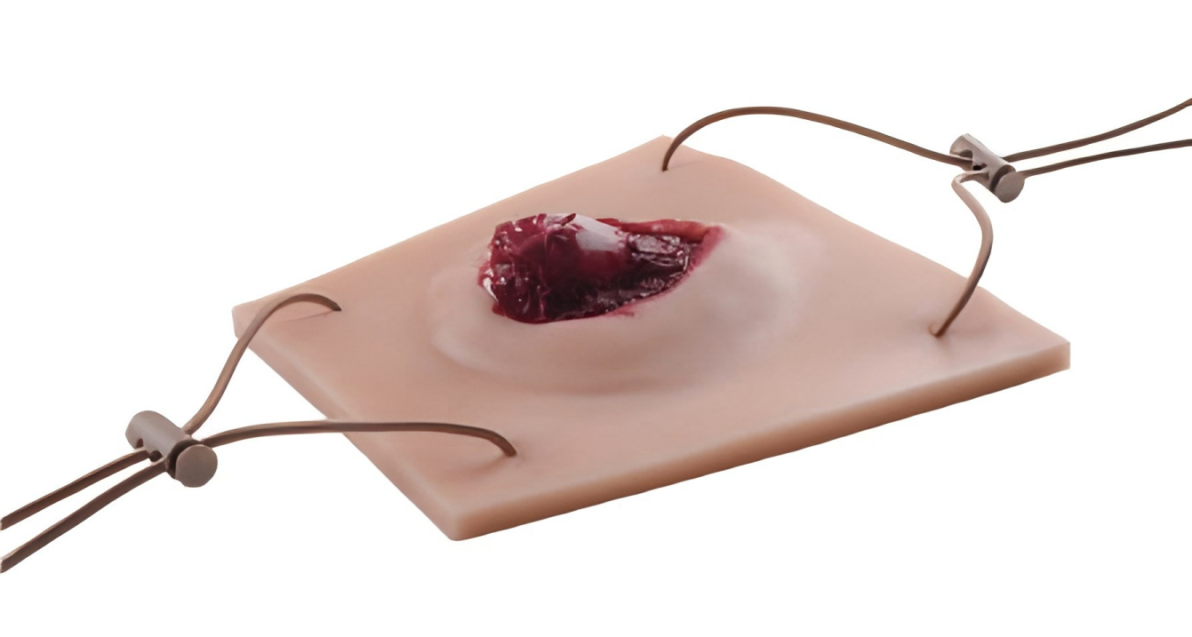 Limb Open Fracture Module