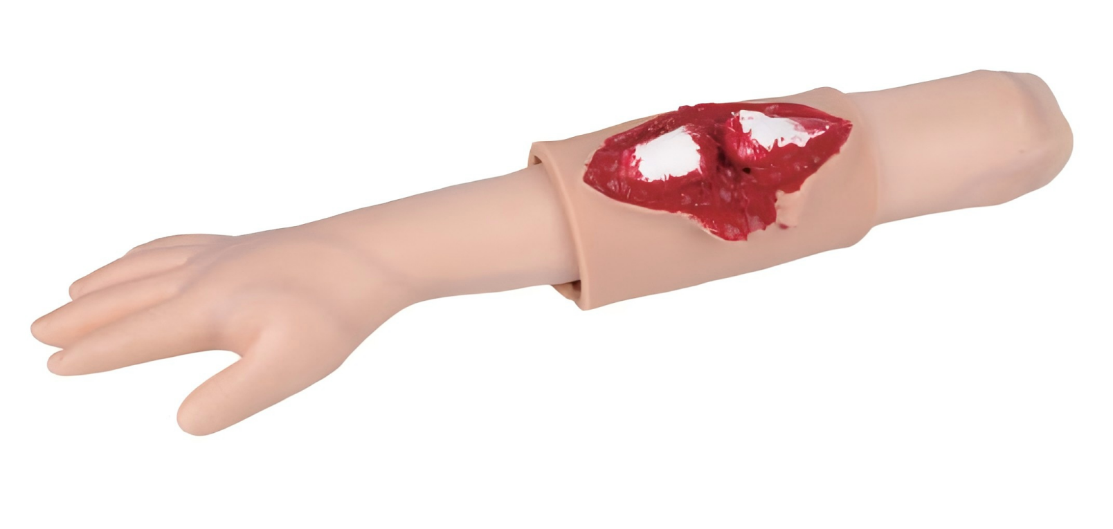 Open Fracture of Tibia Training Module