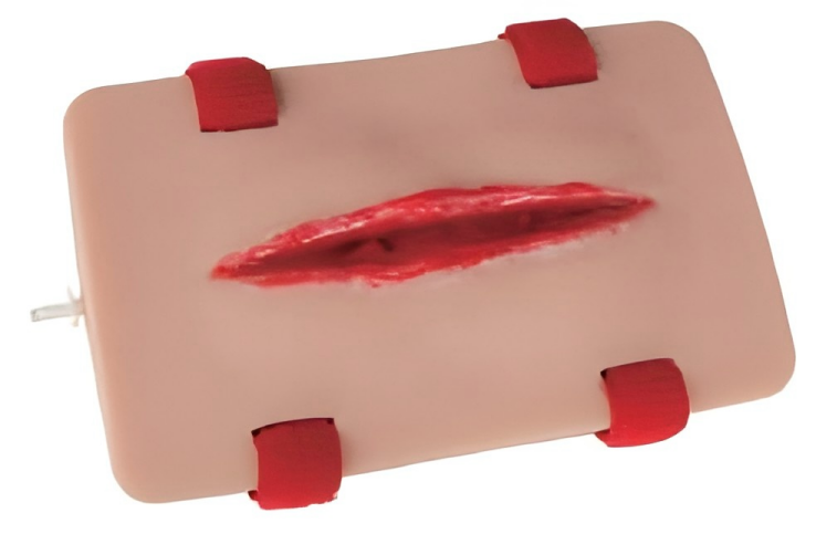 Open Fracture of Tibia Training Module