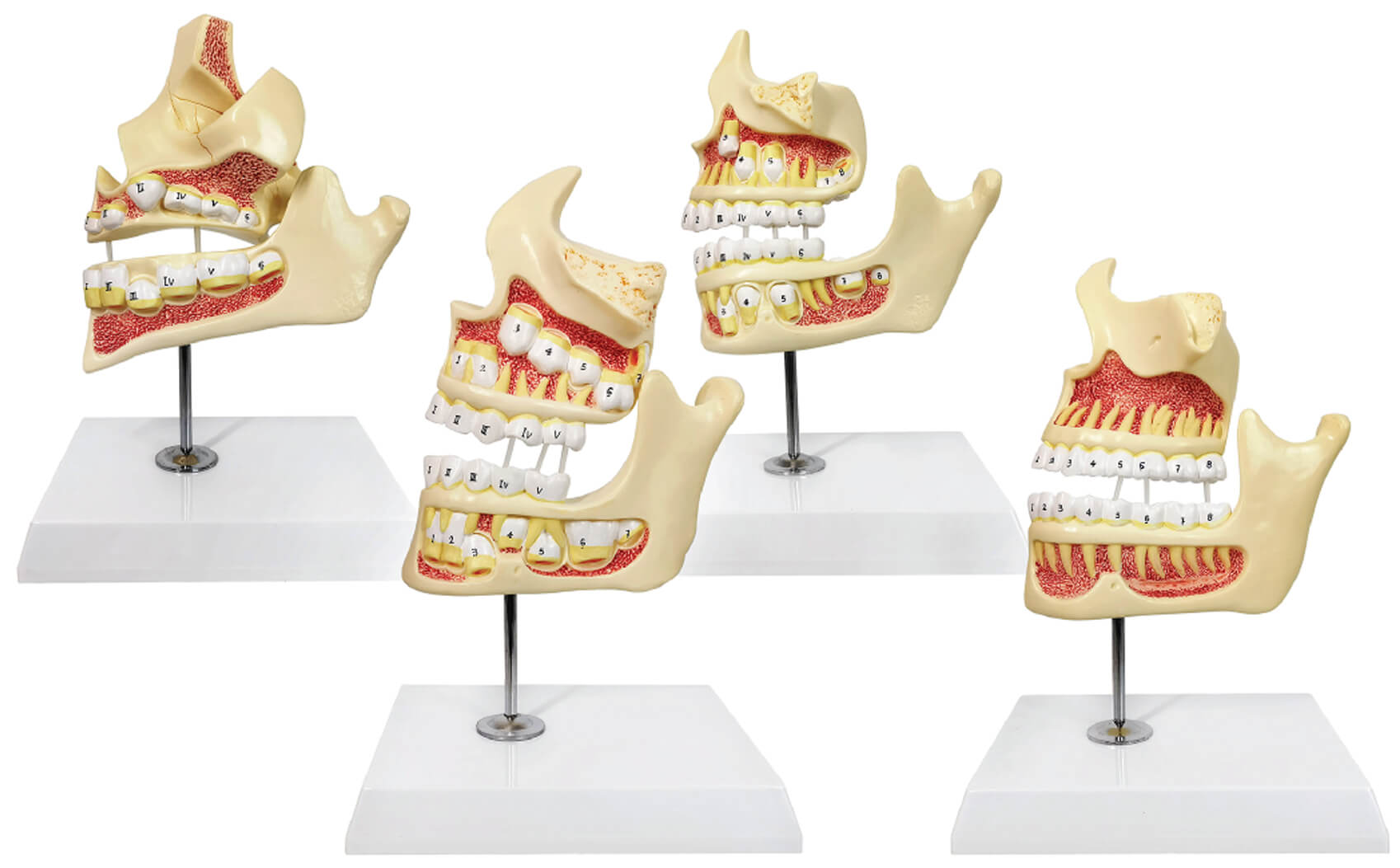 Tooth Development Model, 4 Stages, 4 Parts