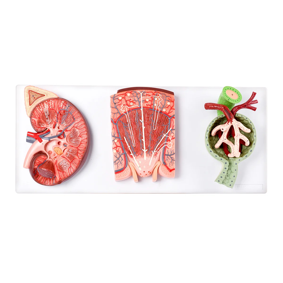 Deluxe Model of Kidney Cross-Section, Nephron, and Glomerulus