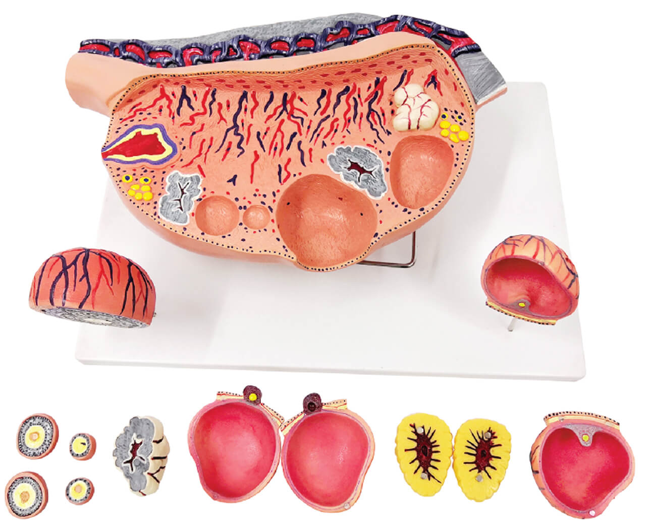 Ovary with Ovarian Follicles & Ovulation (12× Enlarged), 13 Parts