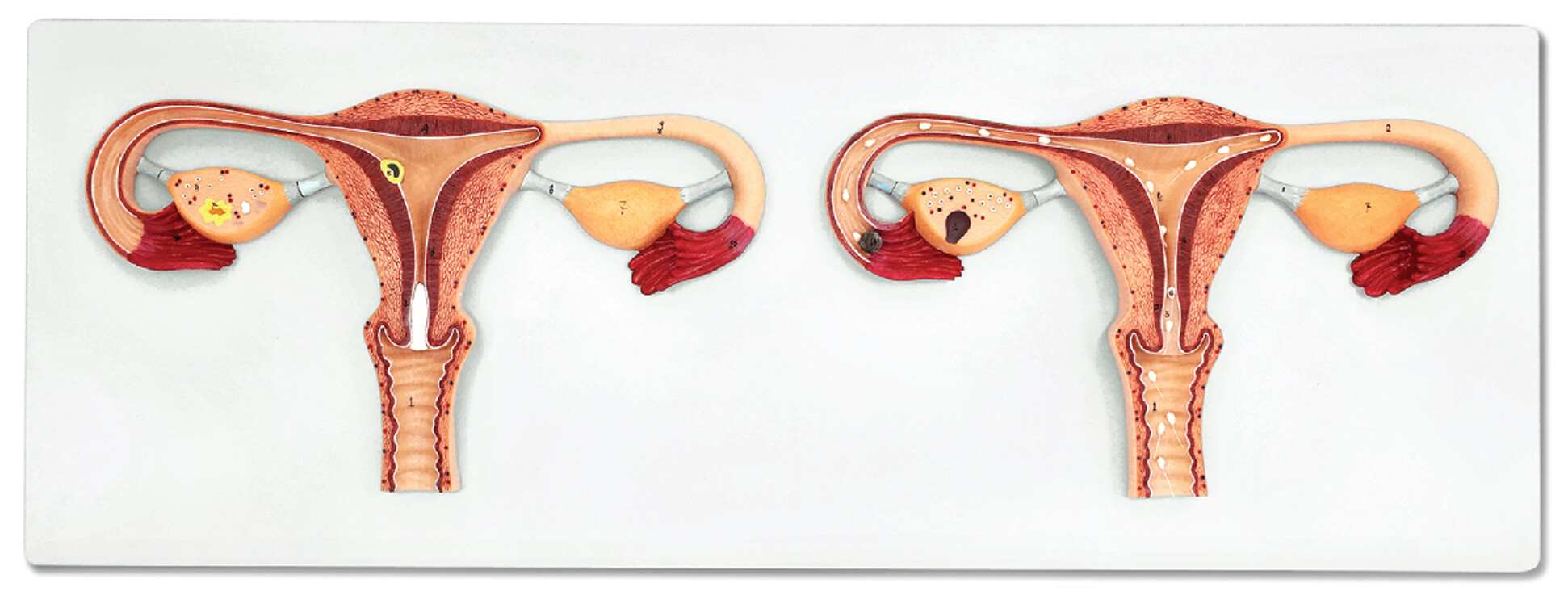 Fertilization Process Model, 2 Parts