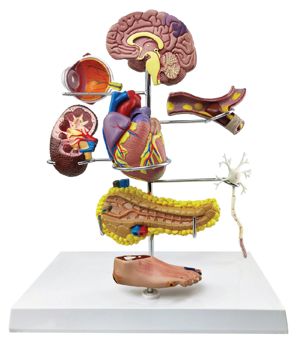 Diabetes Disease Organs Model, 9 Parts