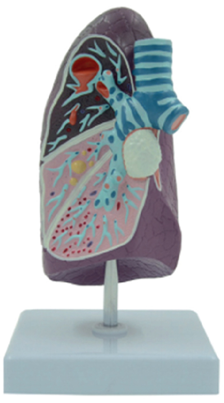 Pathological Model of the Lung, 2/3 Life Size, 1 Part