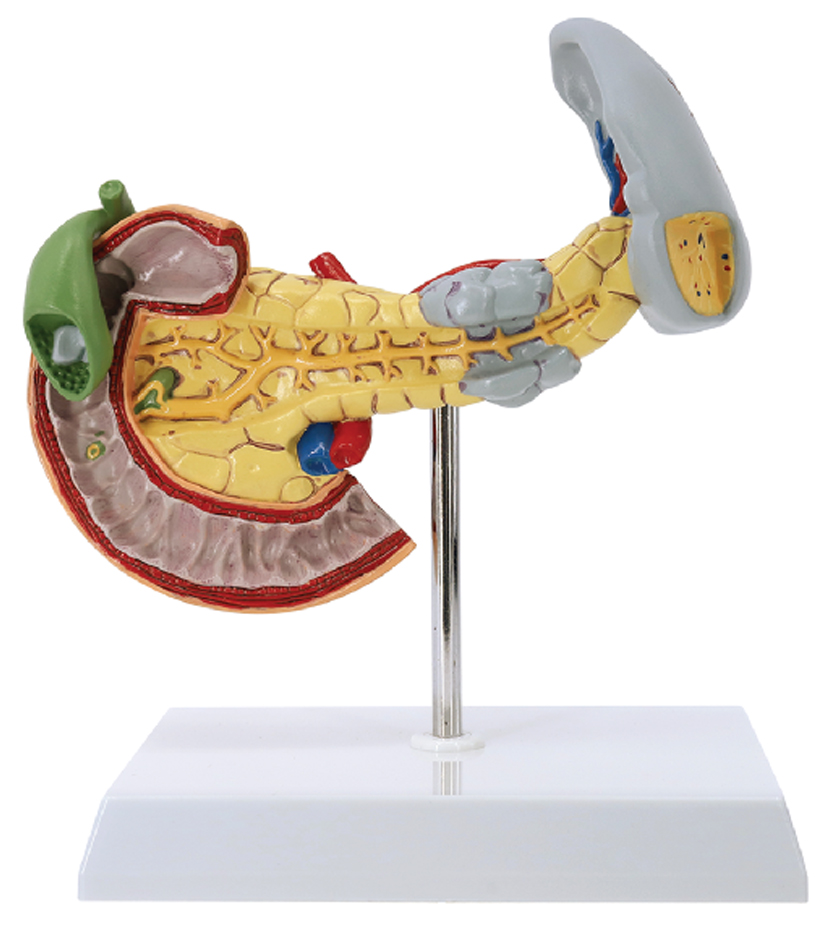 Pathological Model of the Pancreas, Spleen, and Duodenum, Life Size