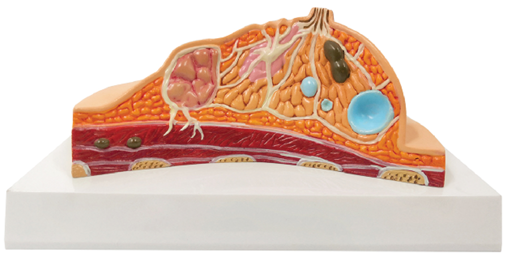 Pathological Model of Breast