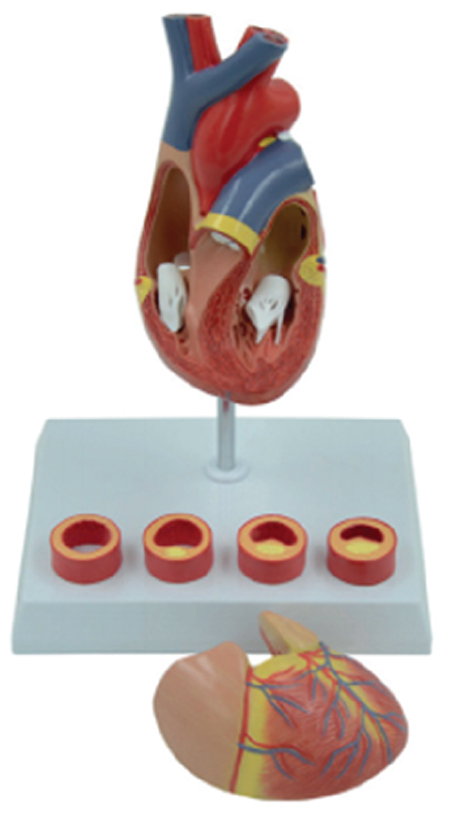 Heart Model with Blood Clot, 6 Parts