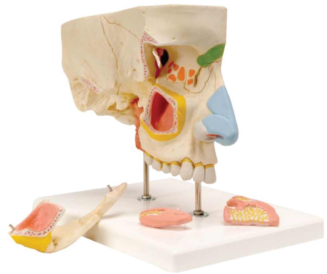 Nose with Paranasal Sinuses(3x Enlarged), 5 Parts