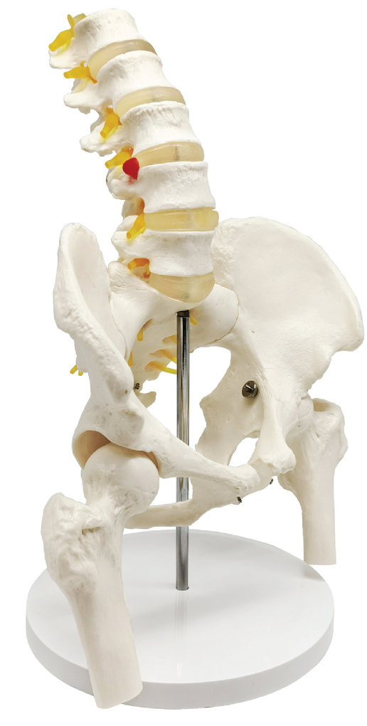 Male Pelvis with Lumbar Vertebrae (L1-L5) and Femur Heads